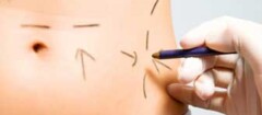 cirurgia-plastica-taboao-da-serra-1476115904